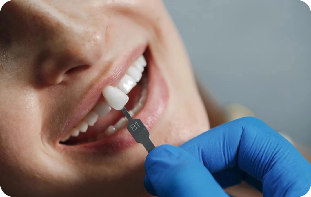 dental implant new 1