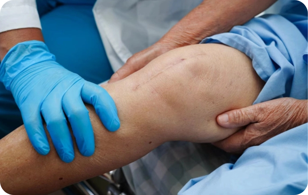 knee replacement new